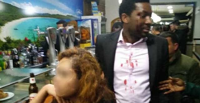 Attacker of black actor in Madrid: 