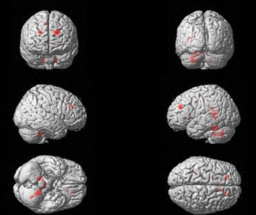 Imágenes tridimensionales del cerebro que muestran las zonas que se activan con el lenguaje