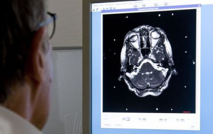 Una vacuna personalizada mejora la supervivencia contra el cáncer cerebral más letal