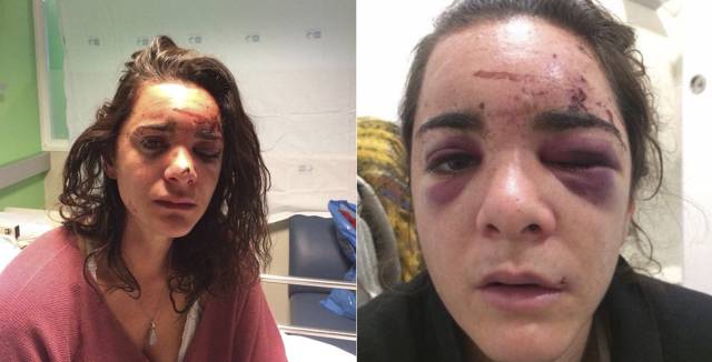 American student attacked and raped in Madrid neighborhood of Aluche