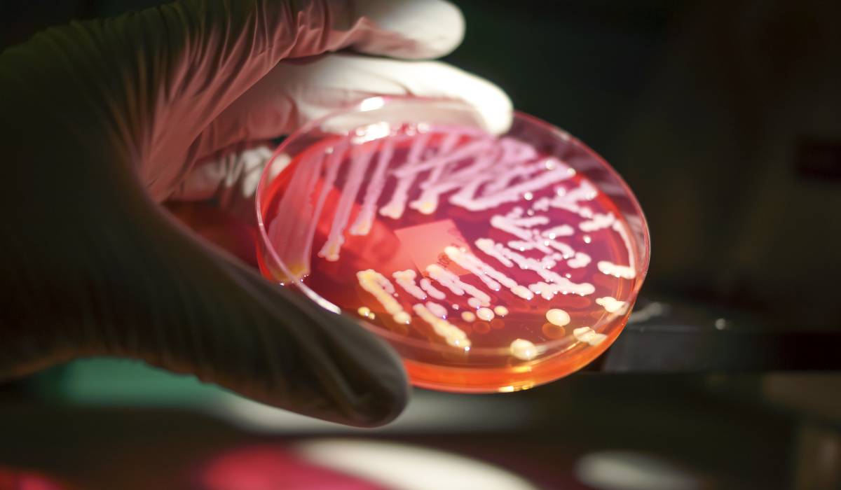 Las superbacterias ya matan más que el sida, la malaria y el cáncer de pulmón